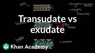 Transudate vs exudate  Respiratory system diseases  NCLEXRN  Khan Academy [upl. by Hamford894]