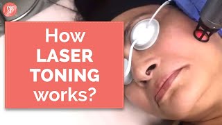 Laser Skin Toning Treatment  Pigmentation  Laser Toning Treatment in New Delhi Gurgaon [upl. by Stacy]