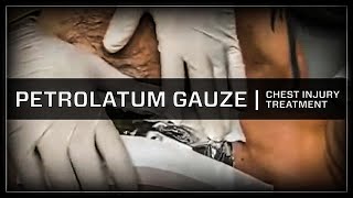 Treatment of Chest Injury with Petrolatum Gauze [upl. by Tammara]