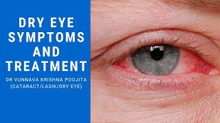 What is Dry Eyes Symptoms  Dry Eyes Treatment  Dry Eye Test  Sharp Sight [upl. by Yesiad]