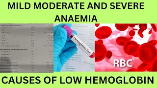 LOW HBHEMOGLOBINCAUSES SYMPTOMSCLASSIFICATION OF ANEMIAMILD MODERATE AND SEVERE ANAEMIA [upl. by Garland391]