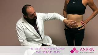 Liposuction Contour Irregularity  Stubborn Lipo Lumps and Bumps [upl. by Joline843]