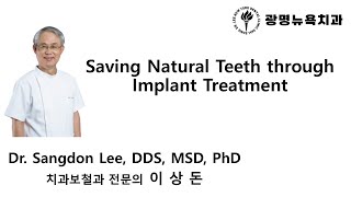 Saving Natural Teeth through Implant Treatment [upl. by Ahsinid]