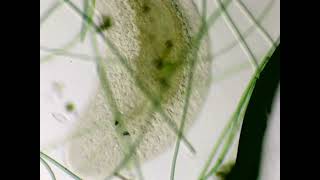 Fat flatworm under microscope [upl. by Akerahs]