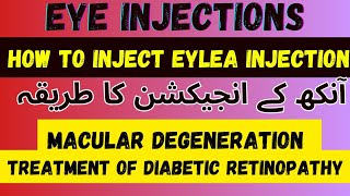 Intravitreal Eylea injection 💉  Intravitreal AntiVegf Injection  Dr Faisal Anwar [upl. by Washburn]