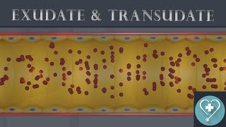 Exudate and Transudate  Introduction  Pathology [upl. by Aramen]