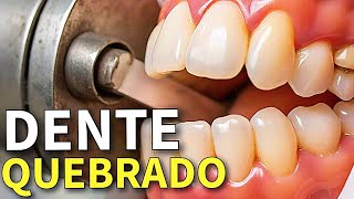 RESTAURAÇÃO DE DENTE EM CASA [upl. by Atterahs528]