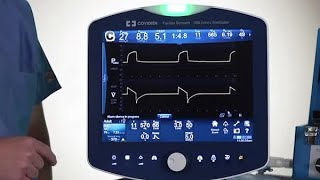 Puritan Bennett™ 980 Ventilator Basic Lesson Mode Setting Changes [upl. by Fortunio]