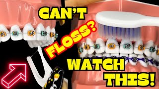 How to BRUSH and FLOSS your TEETH with BRACES ON  TUTORIAL   BRUSHING  FLOSSING [upl. by Nomead]