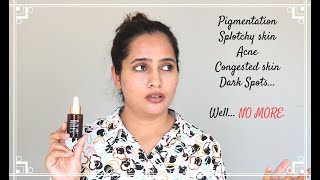 SESDERMA AZELAC RU Liposomal Serum TRX Review  Hindi [upl. by Mooney]