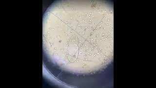 Miracidia schistosoma haematobium in urine [upl. by Tripp]