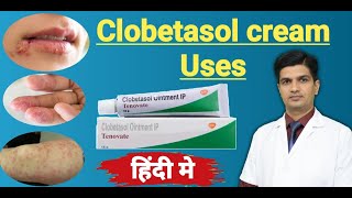 Clobetasol Propionate cream uses  Tenovate cream Uses in hindi [upl. by Yracaz]