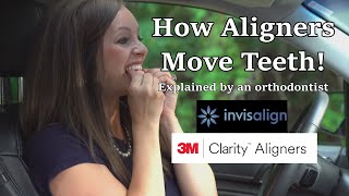 How aligners like Invisalign move teeth  Time lapse explained [upl. by Offen56]