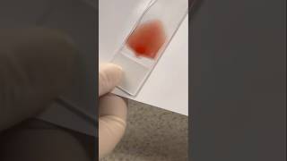 Blood smear 💉🩸  smear practical  blood practical medical neet satyujribadiya doctor shorts [upl. by Esylla]