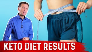 Keto Diet Results – What to Expect – Dr Berg [upl. by Yusuk]