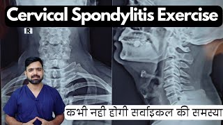 Exercises for cervical spondylitis  Cervical spondylosis exercise in hindi  gardan ki exercise [upl. by Peterson986]