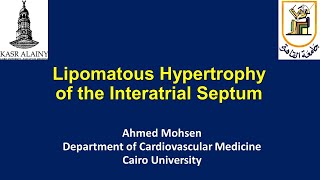 Lipomatous hypertrophy of the Interatrial Septum Lipomatous atrial septal hypertrophy LASH [upl. by Jordanna]