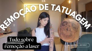 REMOÇÃO DE TATUAGEM A LASER [upl. by Lletnahc]