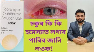 Toba Eye Drops Tobramycin Ophthalmic Solution USP [upl. by Agemo803]