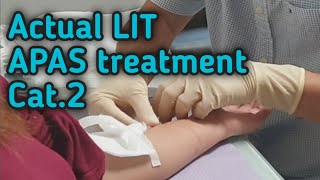 LIT INJECTION FOR APAS TREATMENT  1st therapy  My IVF Journey apaspositivecategory2 [upl. by Ahsaya]