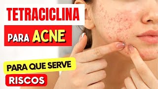 TETRACICLINA PARA ACNE e mais  O que você PRECISA SABER Como Tomar Riscos e Para Que Serve [upl. by Maeve970]