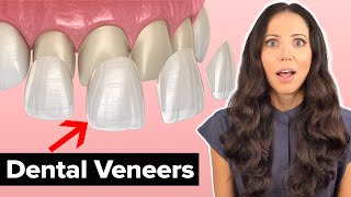 Dental Veneers Procedure Explained [upl. by Nivk]