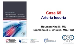 Case 65 PCI Manual  Arteria lusoria and STEMI [upl. by Turne]