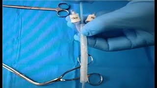 Epistaxis Balloon Catheters [upl. by Zachariah]