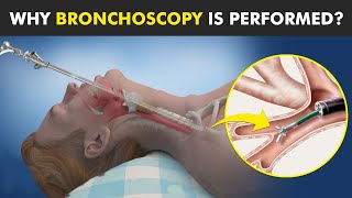 Bronchoscopy  Procedure To View Inside Of Air Ways [upl. by Adnesor]