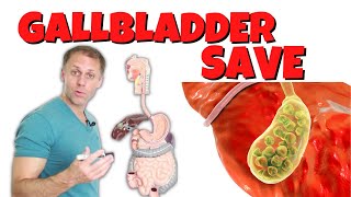 How to Save a Gallbladder and Get Rid of Gallstones [upl. by Yarg549]