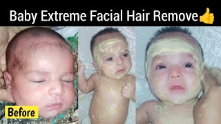 How to remove unwanted hair from babys face  Baby facial hair removal [upl. by Agnimod]