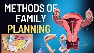 methods of family planning [upl. by Seira]