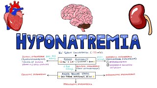 An Approach to Hyponatremia  Hyponatremia Diagnostic Algorithm  Hyponatremia Causes MADE EASY [upl. by Aowda]