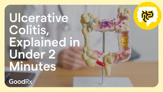 Ulcerative Colitis Explained in Under 2 Minutes  GoodRx [upl. by Gery]