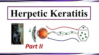 Herpetic Keratitis  Therapy Part II [upl. by Judah]