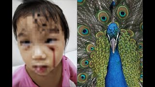 Man Killed By A Peacock  5 Peacock Attacks That Left People Traumatized [upl. by Hairim]