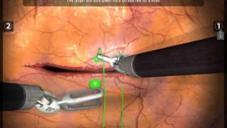 Suturing a Horziontal Incision with Mimics dVTrainer® Robotic Surgery Skills Simulator [upl. by Esalb310]