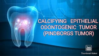 CALCIFYING EPITHELIAL ODONTOGENIC TUMOR PINDBORGS TUMOR [upl. by Jegar]