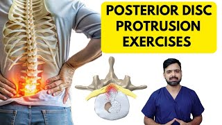 Posterior Disc Protrusion L4L5 L5S1  Exercise  Dr Sunil Physio [upl. by Sheya]