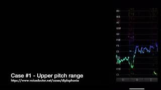 Case study 1 roughness upper range assessment [upl. by Sutherlan]