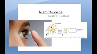 Ophthalmology 121 a AcanthAmoeba Keratitis Pseudo Dendrites eye cornea Contact lens PHMB [upl. by Odnomor454]