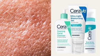 Top 5 CeraVe Skincare for Oily  Combination Skin Types [upl. by Areit]