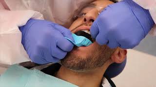 Taking a Maxillary Alginate Impression A Complete Video [upl. by Atnwahs]