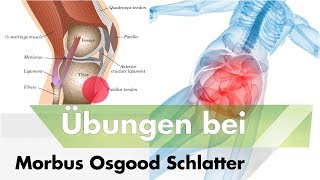 Morbus Schlatter  Diese Übungen können helfen [upl. by Levania]