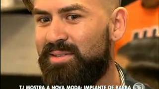 Implante de barba é a nova moda masculina [upl. by Einyaj646]