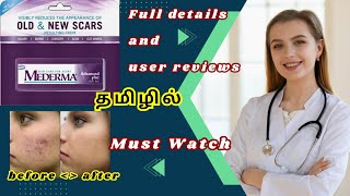 Best and Worst mederma cream review  Mederma cream  thalumbu cream  Scar  தழும்பு  beauty [upl. by Haseefan]