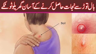 How To Get Rid Of Boils Overnight  Natural Treatment At Home  Bal Tor ka Ilaj [upl. by Anaihs]