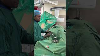 देखिए कैसे होता है वैरिकोसेल का इलाज  Live Varicocele Embolization shortsfeed2024 livesurgeryroom [upl. by Anuahsed920]