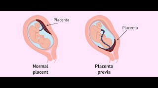 Placenta development part 1general embryologyشرح بالعربي [upl. by Brightman]