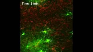 Realtime imaging of supramolecular nanofibers [upl. by Aimet752]